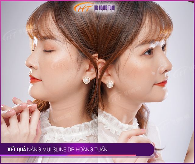 Hình ảnh 2 của Thẩm Mỹ Hoàng Tuấn Hải Phòng