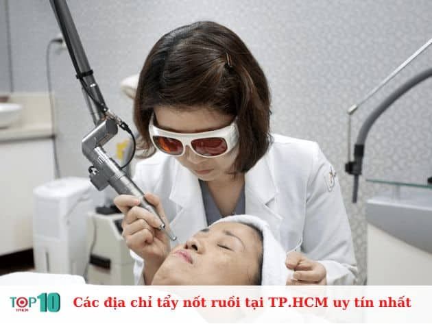 Danh sách các địa chỉ tẩy nốt ruồi uy tín nhất tại TP.HCM