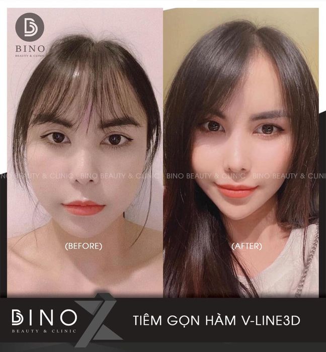 Hình ảnh Bino Beauty & Clinic 1