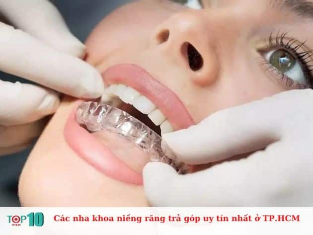 Danh sách các nha khoa niềng răng trả góp uy tín nhất tại TP.HCM