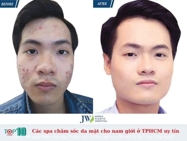 Các spa uy tín tại TPHCM chuyên chăm sóc da mặt cho nam giới