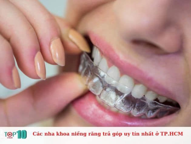 Những nha khoa uy tín tại TP.HCM cung cấp dịch vụ niềng răng trả góp