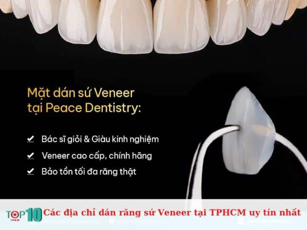 Những địa chỉ uy tín dán răng sứ Veneer tại TPHCM