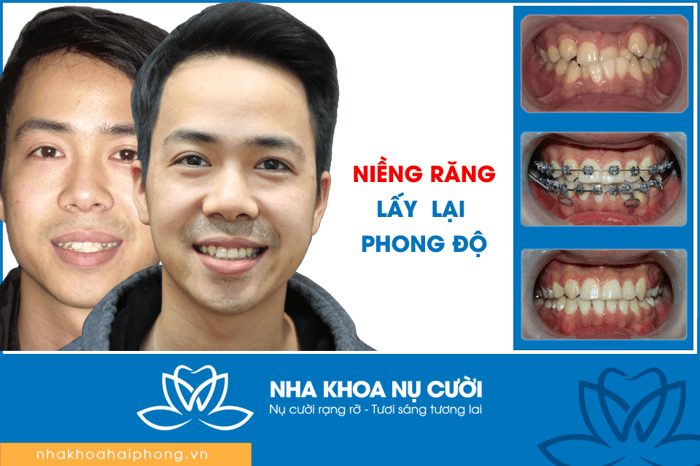 Hình ảnh Nha Khoa Nụ Cười Hải Phòng