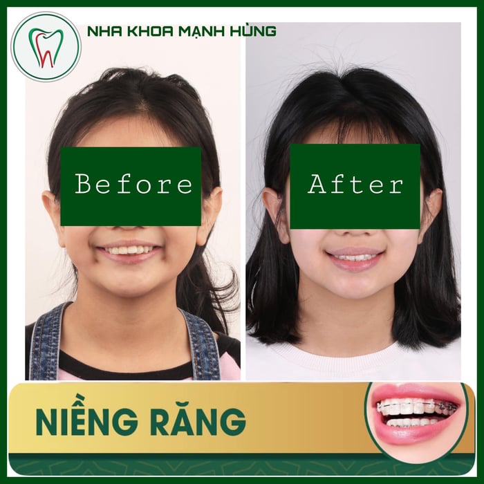 Hình ảnh Nha Khoa Mạnh Hùng - 2