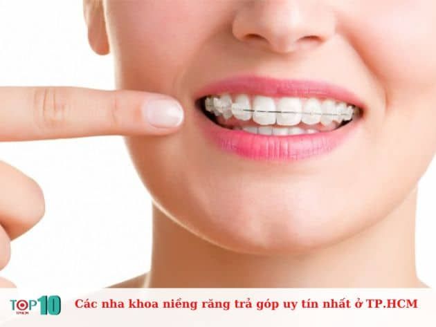 Những địa chỉ niềng răng trả góp uy tín nhất tại TP.HCM