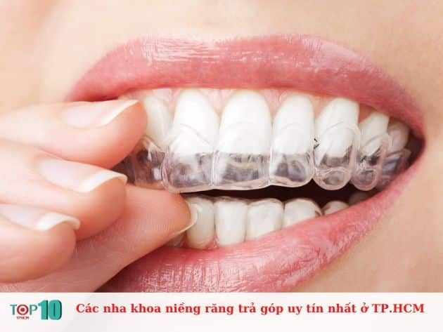 Danh sách các nha khoa uy tín tại TP.HCM chuyên trả góp niềng răng