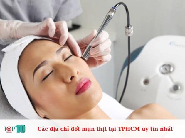 Các địa chỉ đốt mụn thịt tại TP.HCM uy tín nhất