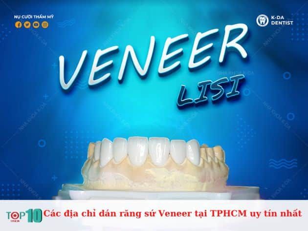 Danh sách các địa chỉ dán răng sứ Veneer uy tín tại TP.HCM