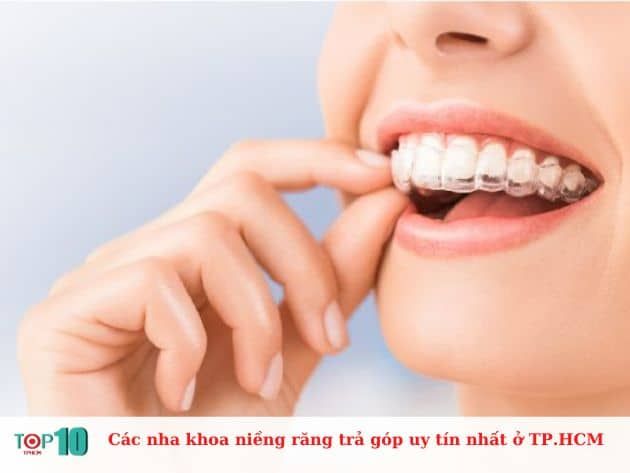 Những địa chỉ nha khoa niềng răng trả góp đáng tin cậy nhất tại TP.HCM