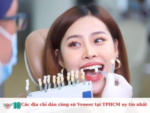 Những địa chỉ dán răng sứ Veneer uy tín tại TPHCM