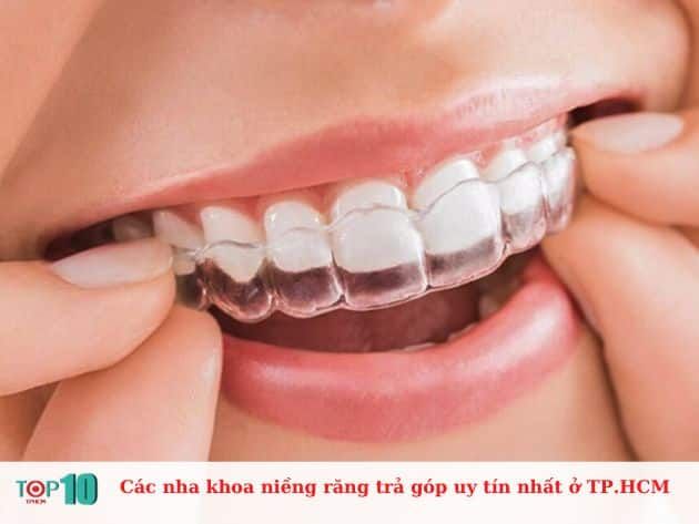 Những nha khoa niềng răng có dịch vụ trả góp đáng tin cậy tại TP.HCM