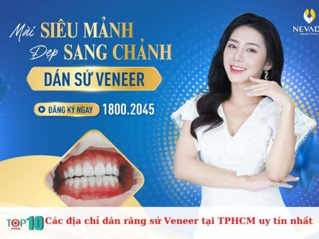 Những địa chỉ dán răng sứ veneer uy tín nhất tại TPHCM