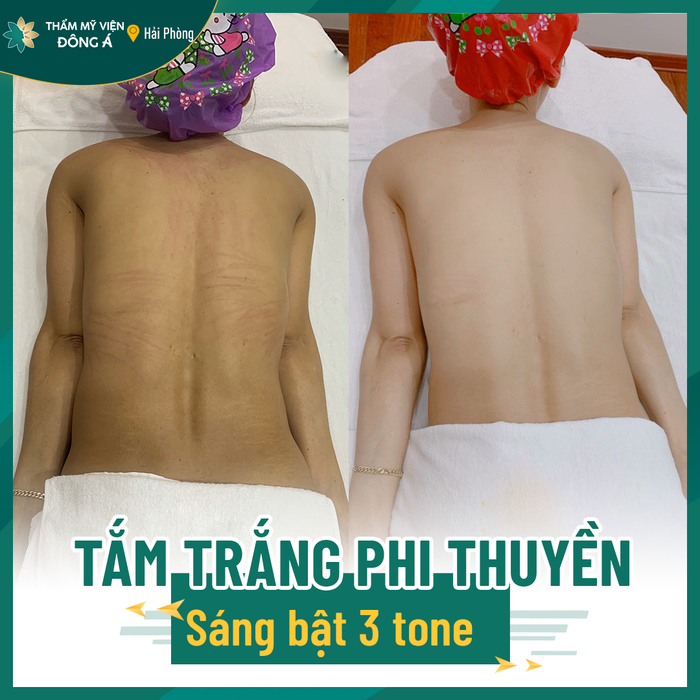 Thẩm Mỹ Viện Đông Á - Chi Nhánh Hải Phòng ảnh 2