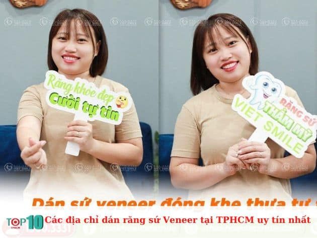 Những địa chỉ dán răng sứ Veneer uy tín tại TPHCM