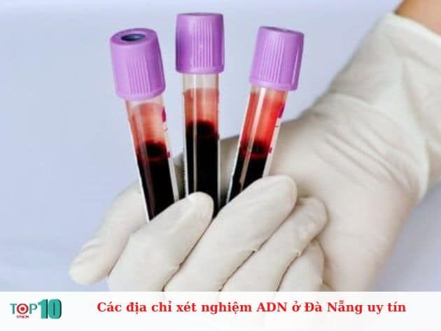 Các địa chỉ xét nghiệm ADN đáng tin cậy tại Đà Nẵng