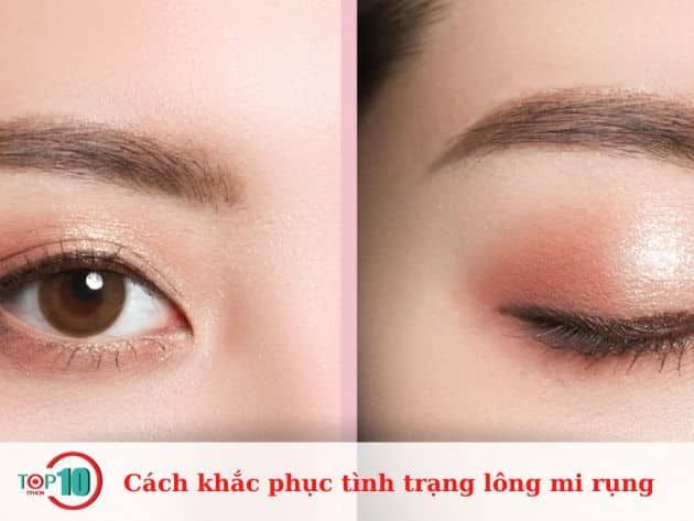 Giải pháp hiệu quả cho tình trạng lông mi rụng