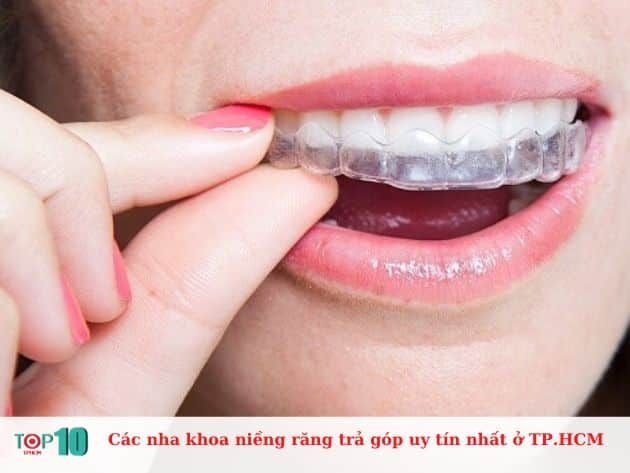 Những nha khoa niềng răng trả góp uy tín tại TP.HCM