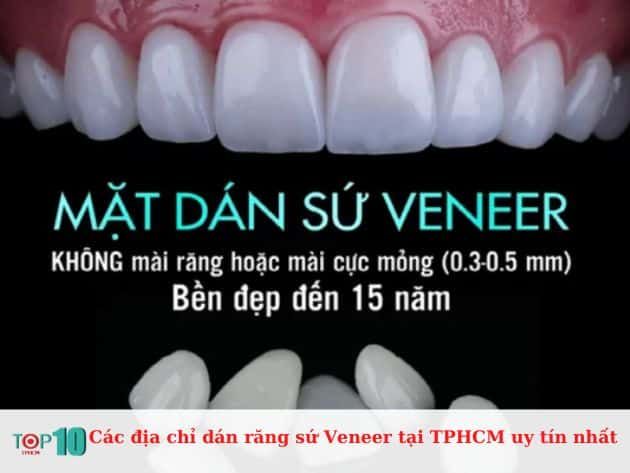 Các cơ sở dán răng sứ veneer uy tín tại TP.HCM