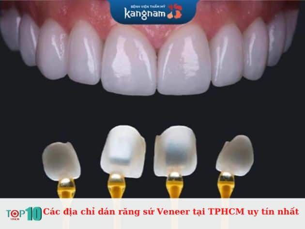 Danh sách các địa chỉ dán răng sứ Veneer uy tín tại TPHCM