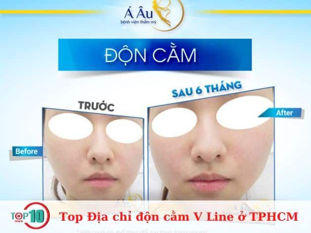 Bệnh viện thẩm mỹ Á Âu