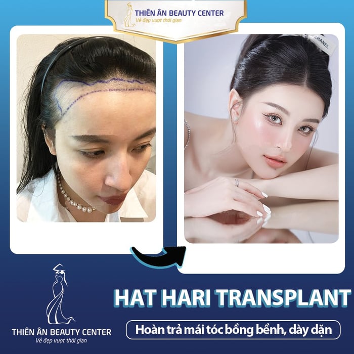 Hình ảnh 1 của Thiên Ân Beauty Center