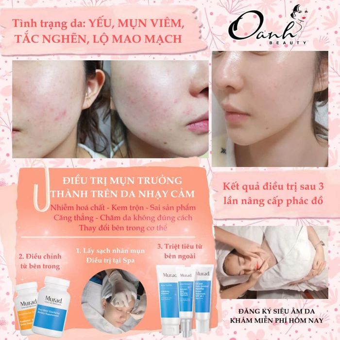 Spa trị mụn tại Quận 1 - Oanh Beauty