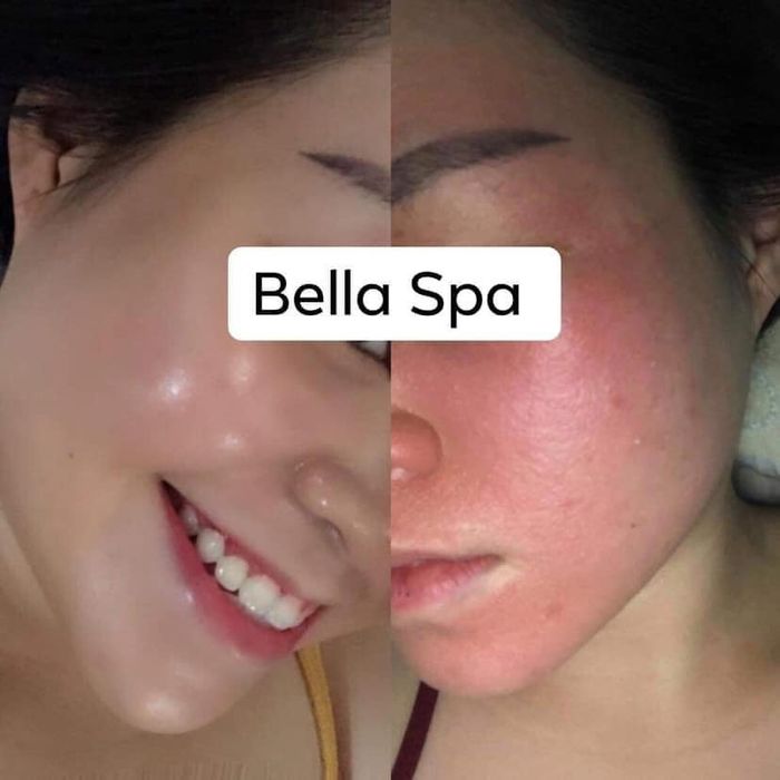 Ảnh 3 của Bella Spa