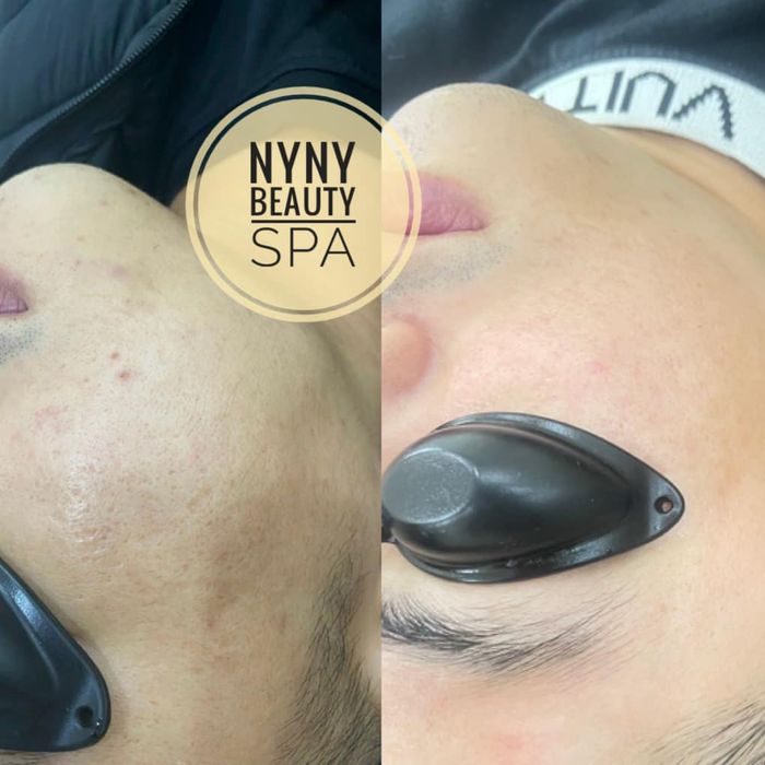 Hình ảnh 2 của NyNy Beauty Spa