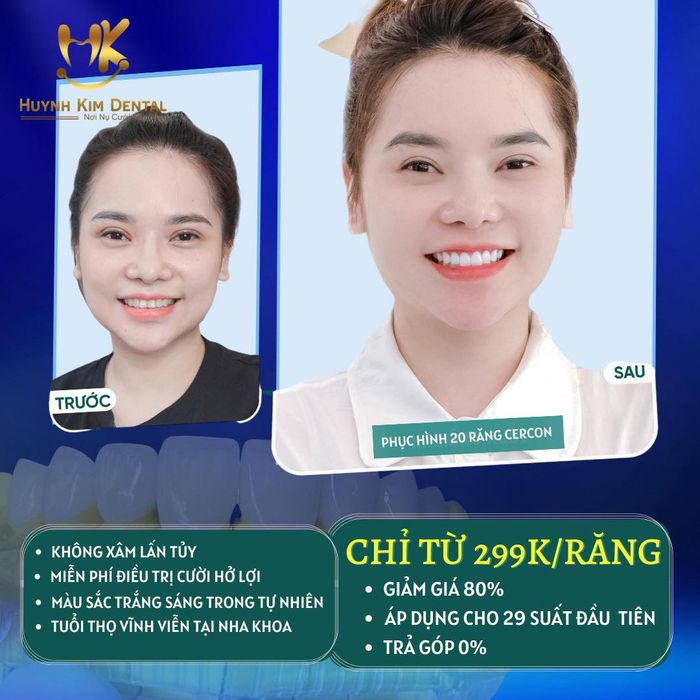 Hình ảnh Nha Khoa Thẩm Mỹ Quy Nhơn - Huỳnh Kim Dental 1