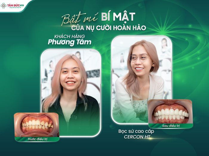 Hình ảnh Nha Khoa Tâm Đức Smile Quy Nhơn 1