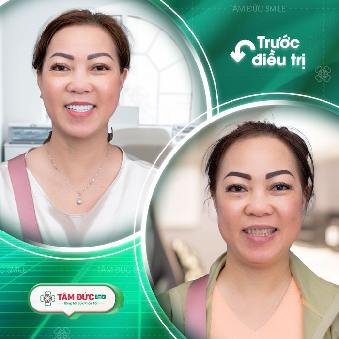 Hình ảnh Nha Khoa Tâm Đức Smile Quy Nhơn 2