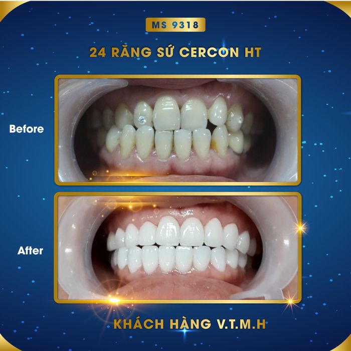 Nha Khoa Nụ Cười Việt hình ảnh 2