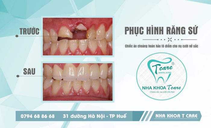 NHA KHOA T CARE ảnh 1