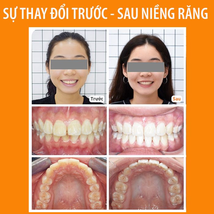 Hình ảnh Up Dental - 1