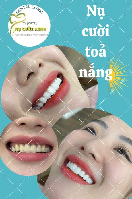 Hình ảnh Nha Khoa Thạch Trụ - Nụ Cười Rạng Rỡ 1