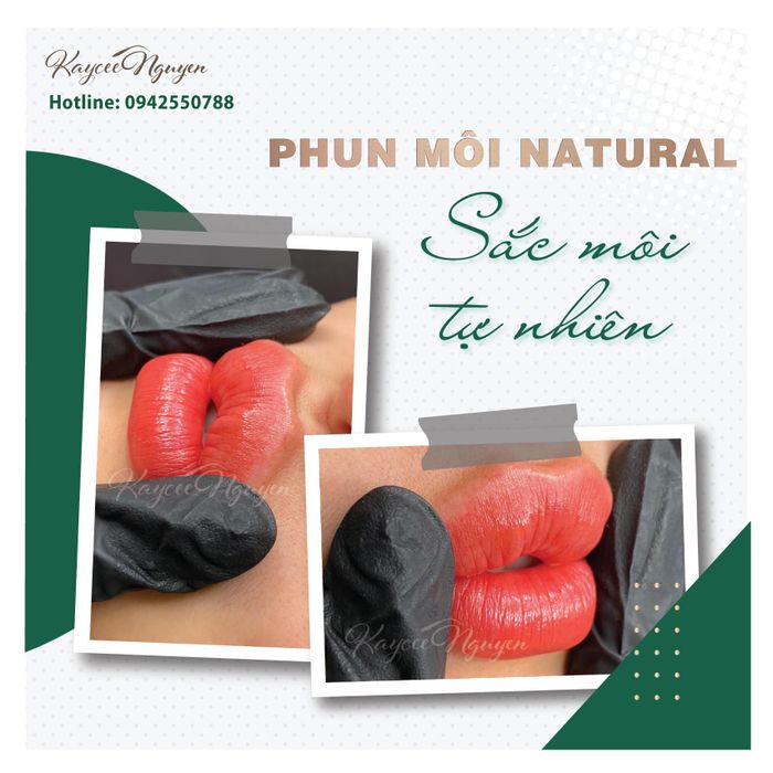 Thẩm Mỹ Kaycee Nguyễn ảnh 1