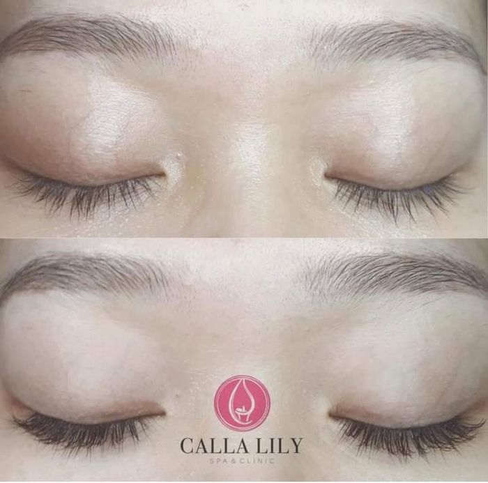 Hình ảnh 2 của Calla Lily Spa & Clinic