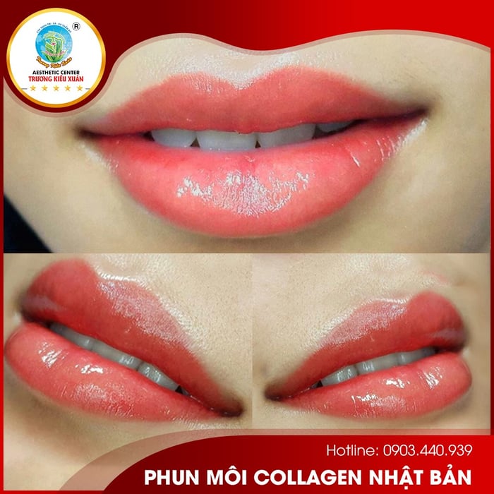 Ảnh 2 của Thẩm mỹ viện Trương Kiều Xuân