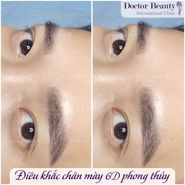 Hình ảnh 1 từ Viện Thẩm Mỹ Quốc Tế Doctor Beauty