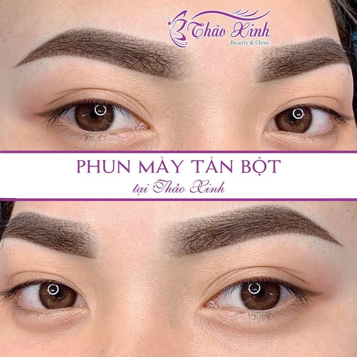 Thẩm mỹ viện Thảo Xinh - Ảnh 2