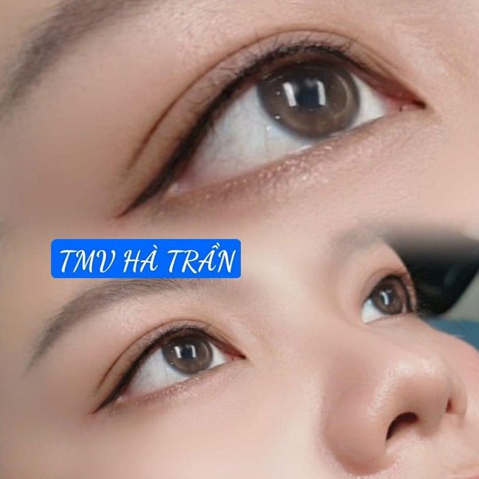 Hình ảnh 2 của Thẩm Mỹ Viện Hà Trần