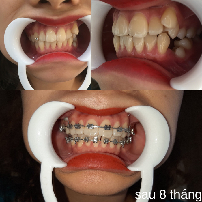 Hình ảnh 2 của Nha khoa Dr Smile - Hải Dương