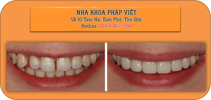 Ảnh 1 của Nha Khoa Pháp Việt