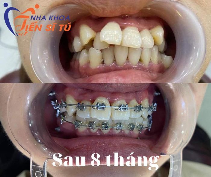 Ảnh 2 của Nha Khoa Tiến Sĩ Tú