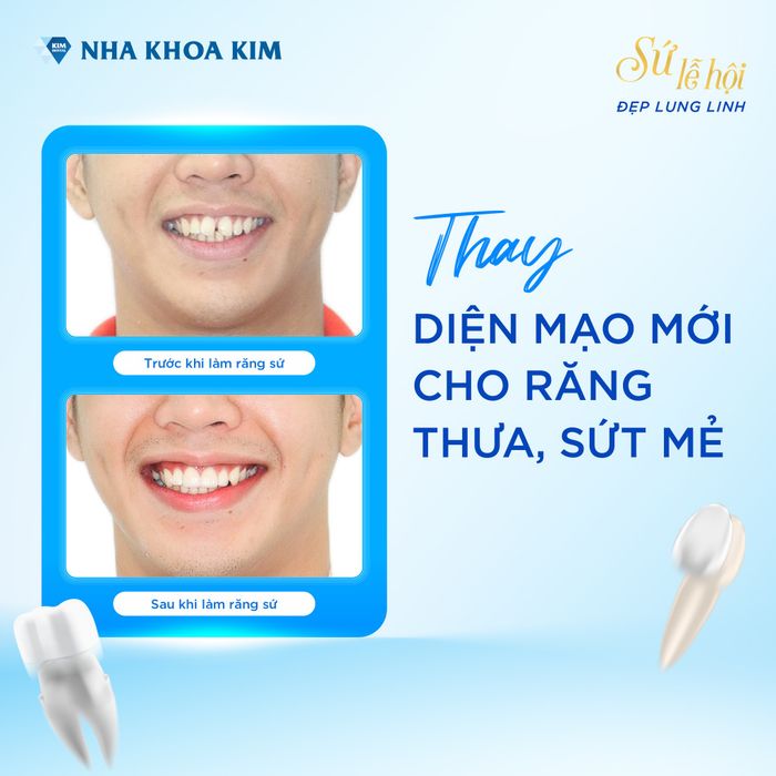 Hình ảnh 1 của Nha Khoa Kim