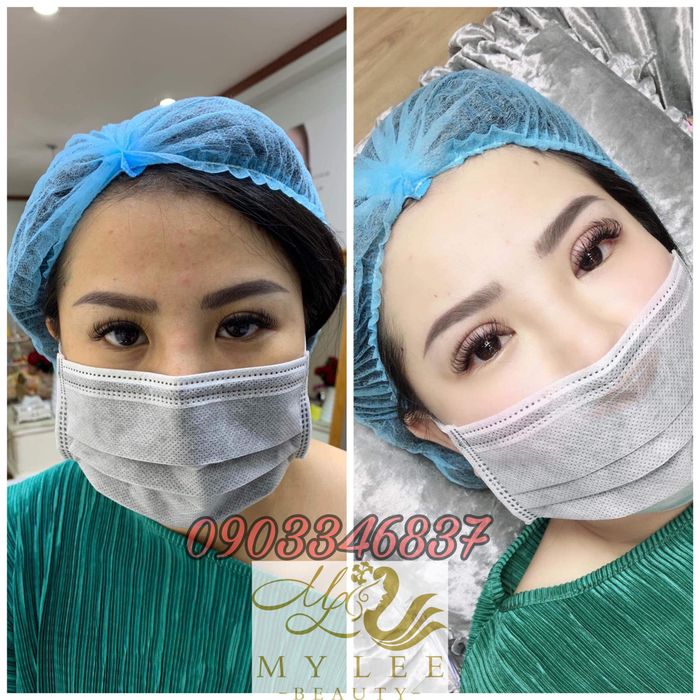 Ảnh 1 của MY LEE Beauty Clinic