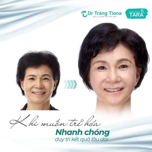 Viện Thẩm mỹ TARA – Bác sĩ Trang