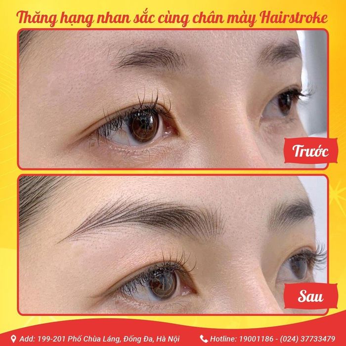 Hình ảnh Viện Thẩm Mỹ Hoài Anh 2