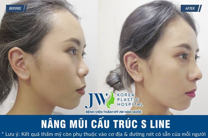 Ảnh 2 của Bệnh viện phẫu thuật thẩm mỹ JW Hàn Quốc